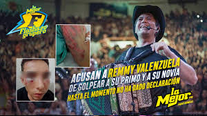 Jun 11, 2021 · remmy valenzuela no ha salido en su defensa después de haber sido acusado por atacar brutalmente a su primo y su novia, pero sí su esposa, quien estaría intentando rescatar la carrera. Acusan A Remmy Valenzuela De Golpear A Su Primo A Su Novia Casi Matarla Video Dailymotion
