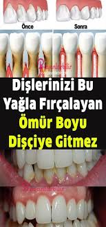 Dis Eti Cekilmesine Bitkisel Tedavi Dogal Dis Beyazlatma Herboloji Bitkisel Tarifler