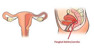 Pada kesempatan kali ini disini kami akan memberikan informasi mengenai cara menyembuhkan fibroid rahim secara alami terbukti manjur dengan obat fibroid rahim tradisional qnc jelly gamat sebagai solusinya. Fibroid Punca Faktor Risiko Dan Cara Rawatan The Diagnosa