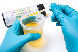 Why Urinalysis Is My Favorite Course Insights