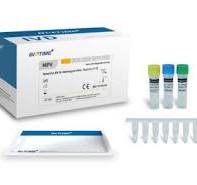 MPV IgG/IgM Rapid Test