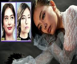 Neslihan Atagul Estetik Oldu