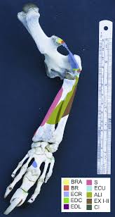 We did not find results for: Origins And Insertions Of The Craniolateral Forearm Muscles In The Download Scientific Diagram