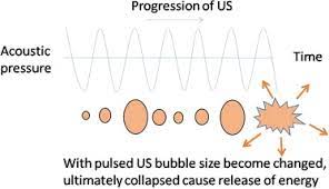 A Review On The Use Of Magnetic Fields And Ultrasound For Non Invasive Cancer Treatment Sciencedirect