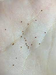 Found These Little Seeds In Bed This Morning Haven T Had Any Bug Bites Whatisthis