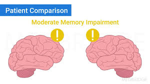 Image result for Memory Evaluation