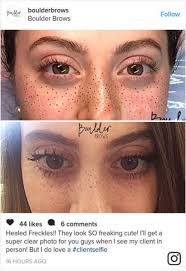 Related Image Henna Henna Freckles In 2020 Freckles Tattooed Freckles Freckles Makeup