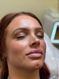 The Skin Room Marshall