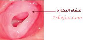 علامات البنت المفتوحة من مشيتها alaylalayl
