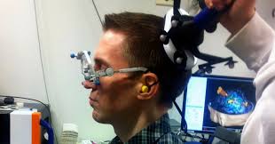 Falling Down a Mountain May Make You a Genius