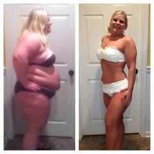 Bariatric Sleeve Before And After Blogs Ammcnutt Attachments 9583 Before And After Pics10 Months And 1 With Images Hot Fashion Hot Outfits Fashion