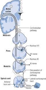 Image result for Progressive Bulbar Paralysis