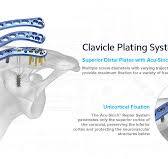 Distal Clavicle Fractures, AC and CC Joint Repair | Acumed ...
