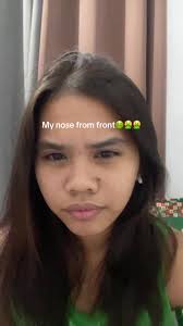 Long Nose and No Jaw Line Side Profile