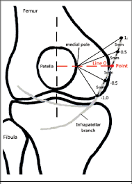 We think this is the most useful anatomy picture that you. Anterior View Of The Right Knee Joint With A Schematic Representation Download Scientific Diagram