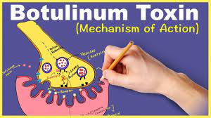 Maybe you would like to learn more about one of these? Botulinum Toxin Mechanism Of Action Youtube