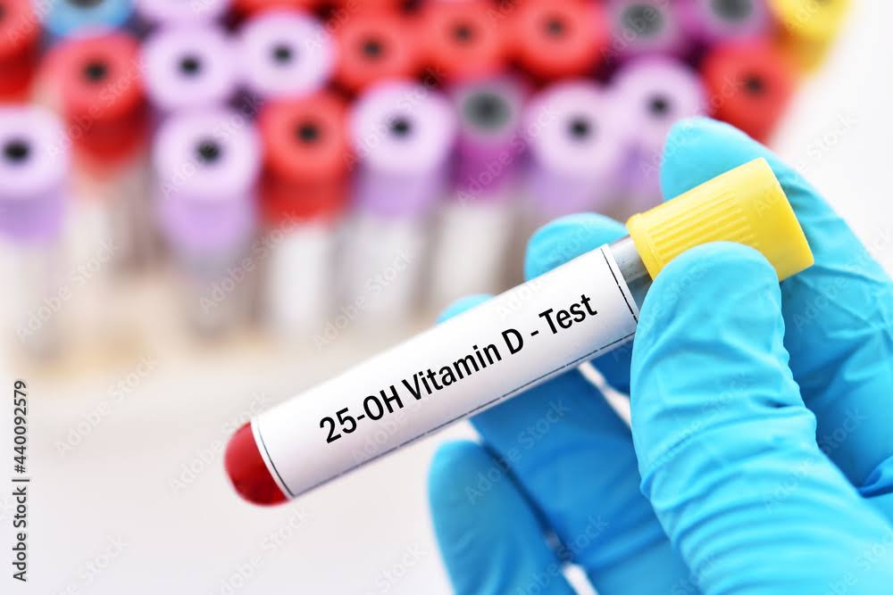 VITAMIN D product image