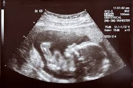 Despite that recommendation, the average number of ultrasounds has increased since the practice was introduced in the 1960s; Who Invented Ultrasound