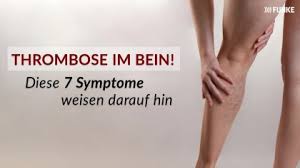 4 Symptome Einer Sinusvenenthrombose Und Behandlungsmoglichkeiten Bildderfrau De