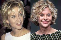 15 idées de Stars avant après chirurgie