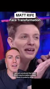 Matt Rife's face transformation. Do you think puberty related changes only  or he's had some work done? #mattrife #mattrifecomedy #mattrifeedit  #mattrifetok #mattrifestandup #celebrityface