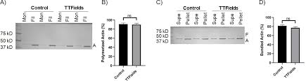 Treatment with tumor-treating fields (TTFields) suppresses intercellular  tunneling nanotube formation in vitro and upregulates immuno-oncologic  biomarkers in vivo in malignant mesothelioma