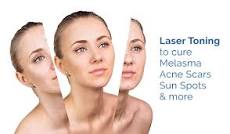 Image result for how much does facial laser treatment cost?