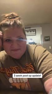 3 weeks post op! Life updates :)#wls #sleeved #bariatriccommunity #vsg  #vsgsurgey