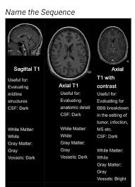 Pin By Trading Shakuni On Neuroanatomy Medical Anatomy Mri Brain Radiology Imaging
