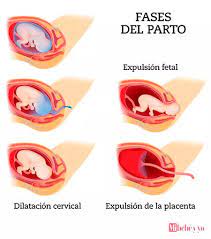 Como Adelantar El Parto Con Metodos Naturales