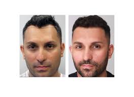 Bosley Hair Transplant & Restoration, 3929 Airport Blvd, Mobile, AL