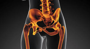 Resultado de imagen para RIESGOS DE LAS PROTESIS DE PIERNAS O BRAZOS