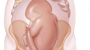 ters dogum belirtileri nelerdir gebe com