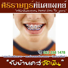 ศ ร ราษฎร ท นตแพทย ซอยเน นพล บหวานพ ทยา ร บย ายเคสจ ดฟ น เร มต น 2 000 บาท ตรวจปร กษาฟร ก อนไม ม ค าใช จ ายในการประเม น ค ณหมอจ ดฟ promotion pattaya dent
