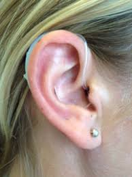 Check spelling or type a new query. Norfolk And Norwich University Hospitals Nhs Foundation Trust Hearing Aids For Adults