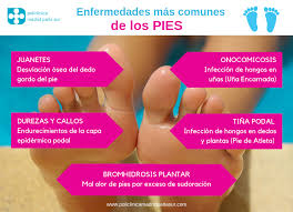 Remedios caseros para curar los hongos de las uñas. Pie De Atleta Prevencion Y Tratamiento