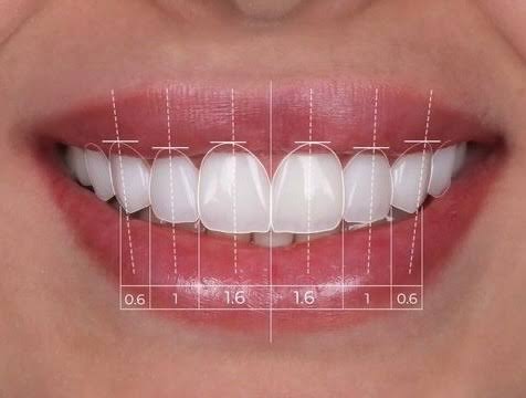 A beautiful smile is all about proportions 🦷✨ The golden ratio helps us  design teeth that look natural, balanced, and timeless.
