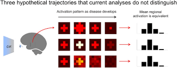 Writing tests can be rather fun! How Pattern Information Analyses Of Semantic Brain Activity Elicited In Language Comprehension Could Contribute To The Early Identification Of Alzheimer S Disease Sciencedirect