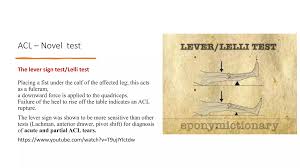 Image result for Lever Test
