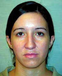 Woman with 16 aliases escapes from Harrison halfway house