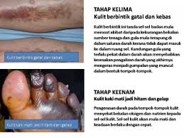 Kencing manis atau istilah perubatannya, 'diabetes mellitus' adalah satu penyakit metabolik yang menyebabkan kandungan gula di dalam darah menjadi jika anda mempunyai tanda tanda diabetes, hanya satu bacaan gula yang tinggi diperlukan untuk mengesahkan anda mempunyai kencing manis. Apa Itu Kencing Manis Diabetes Melitus Surirumah Internet Marketer Shopee Seller Ambassador Dealer Emas