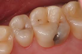 We did not find results for: Remedies I Used For Toothaches While Pregnant What Worked And What Didn T Patient S Lounge