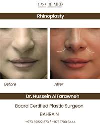 Dr. Hussein Altarawneh