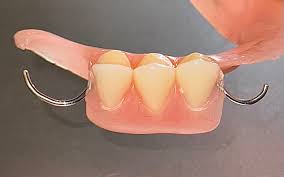 Image result for dentures