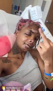 What was Sheila running from when she cut off her toe?