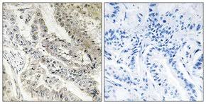 As of 2020 september 19, saturday current price of crbp stock is 1.895$ and our data indicates that the asset price has been in a downtrend for the past 1 year (or since its inception). Anti Crbp Iii Antibody Produced In Rabbit Affinity Isolated Antibody Rbp5 Sigma Aldrich