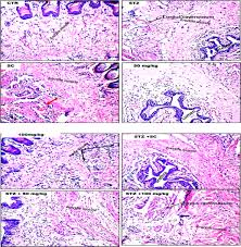 Image result for Massularia