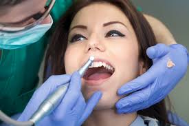Teeth Cleaning Dental Services