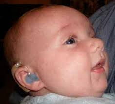 Hearing instrument specialists are individuals who engage in the practice of dispensing or fitting hearing aids. Using Hearing Aids With Babies Aged 0 6 Months Aussie Deaf Kids