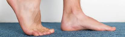 Turf toe injury is most commonly seen when an axial load is delivered to a foot that is fixed in although turf toe is most frequently seen in football players, 9 it can occur in athletes in any sport. Turf Toe Treatment In Sydney Modpod Sports Podiatry